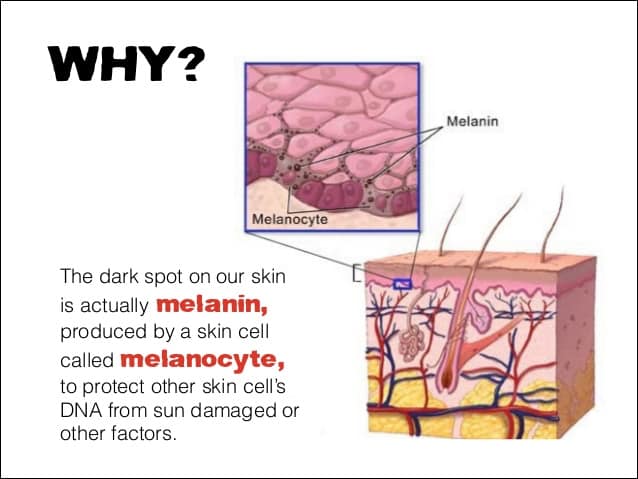 Observation regarding the importance of melanin